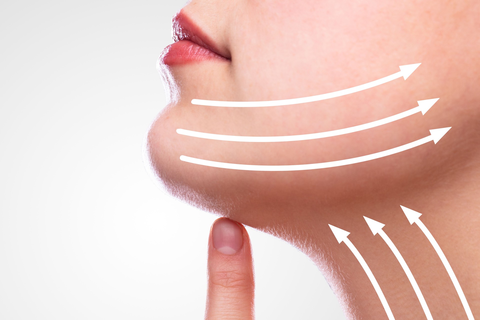 Woman After Face Lifting On Her Face