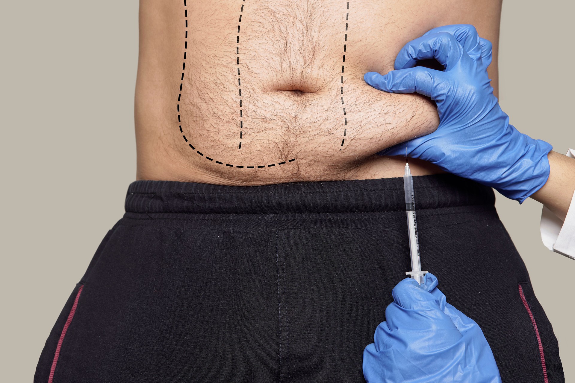 A doctor making injection on a fat male abdomen